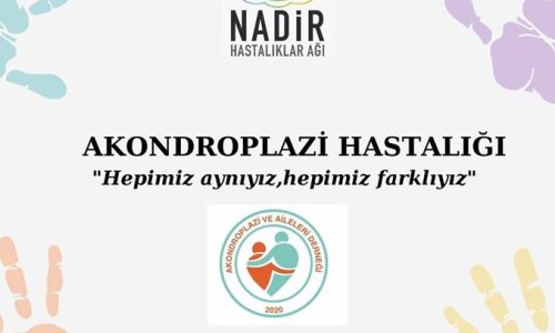 AKONDROPLAZİ VE AİLELERİ DERNEĞİ CANLI YAYINI